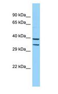 HOXB5 Antibody - HOXB5 antibody Western Blot of Mouse Liver.  This image was taken for the unconjugated form of this product. Other forms have not been tested.