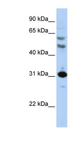HOXB5 Antibody - HOXB5 antibody Western blot of HepG2 cell lysate. This image was taken for the unconjugated form of this product. Other forms have not been tested.