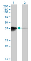 HOXB5 Antibody - Western Blot analysis of HOXB5 expression in transfected 293T cell line by HOXB5 monoclonal antibody (M01), clone 3F10.Lane 1: HOXB5 transfected lysate(29.4 KDa).Lane 2: Non-transfected lysate.