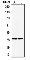 HOXB5 Antibody - Western blot analysis of HOXB5 expression in HepG2 (A); HUVEC (B) whole cell lysates.