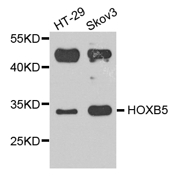 HOXB5 Antibody - Western blot blot of extract of various cells, using HOXB5 antibody.