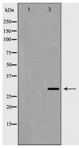 HOXB5 Antibody - Western blot of HOXB5 expression in HUVEC cells