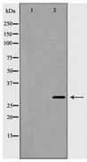 HOXB5 Antibody - Western blot of HOXB5 expression in HUVEC cells