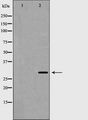 HOXB5 Antibody - Western blot analysis of HOXB5 expression in HuvEc cells. The lane on the left is treated with the antigen-specific peptide.