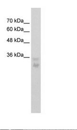 HOXB5 Antibody - HepG2 Cell Lysate.  This image was taken for the unconjugated form of this product. Other forms have not been tested.