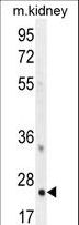 HOXB6 Antibody - HOXB6 Antibody western blot of mouse kidney tissue lysates (35 ug/lane). The HOXB6 antibody detected the HOXB6 protein (arrow).