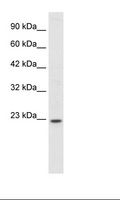 HOXB6 Antibody - Fetal Intestine Lysate.  This image was taken for the unconjugated form of this product. Other forms have not been tested.