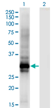 HOXB6 Antibody - Western Blot analysis of HOXB6 expression in transfected 293T cell line by HOXB6 monoclonal antibody (M01), clone 8E3.Lane 1: HOXB6 transfected lysate (Predicted MW: 25.4 KDa).Lane 2: Non-transfected lysate.