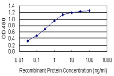 HOXB6 Antibody - Detection limit for recombinant GST tagged HOXB6 is 0.03 ng/ml as a capture antibody.