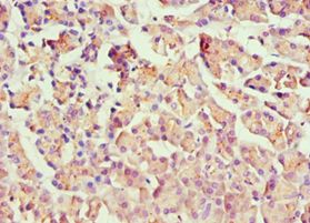 HOXB7 Antibody - Immunohistochemistry of paraffin-embedded human pancreas using antibody at 1:100 dilution.