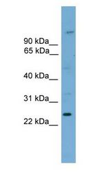 HOXB7 Antibody - HOXB7 antibody Western Blot of NIH3T3.  This image was taken for the unconjugated form of this product. Other forms have not been tested.