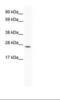 HOXB7 Antibody - Large Intestine Lysate.  This image was taken for the unconjugated form of this product. Other forms have not been tested.
