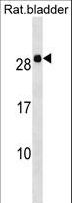 HOXB7 Antibody - Rat Hoxb7 Antibody western blot of Rat bladder tissue lysates (35 ug/lane). The Rat Hoxb7 antibody detected the Rat Hoxb7 protein (arrow).