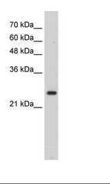 HOXB7 Antibody - Transfected 293T Cell Lysate.  This image was taken for the unconjugated form of this product. Other forms have not been tested.