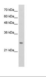 HOXB7 Antibody - Transfected 293T Cell Lysate.  This image was taken for the unconjugated form of this product. Other forms have not been tested.