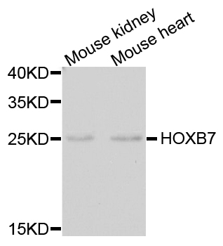 HOXB7 Antibody - Western blot analysis of extracts of mouse testis.