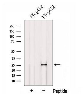 HOXB7 Antibody - Western blot analysis of extracts of HepG2 cells using HOXB7 antibody. The lane on the left was treated with blocking peptide.