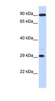 HOXB8 Antibody - HOXB8 antibody Western blot of Fetal Muscle lysate. This image was taken for the unconjugated form of this product. Other forms have not been tested.