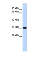 HOXB8 Antibody - HOXB8 antibody Western blot of Fetal Liver lysate. This image was taken for the unconjugated form of this product. Other forms have not been tested.