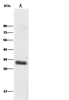 HOXB8 Antibody - Anti-HOXB8 rabbit polyclonal antibody at 1:500 dilution. Lane A: Mouse Liver tissue lysate. Lysates/proteins at 30 ug per lane. Secondary: Goat Anti-Rabbit IgG (H+L)/HRP at 1/10000 dilution. Developed using the ECL technique. Performed under reducing conditions. Predicted band size: 28 kDa. Observed band size: 28 kDa.