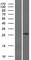 HOXB8 Protein - Western validation with an anti-DDK antibody * L: Control HEK293 lysate R: Over-expression lysate