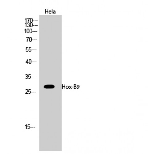 HOXB9 Antibody - Western blot of Hox-B9 antibody