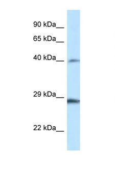 HOXB9 Antibody - HOXB9 antibody Western blot of Rat Muscle lysate. Antibody concentration 1 ug/ml.  This image was taken for the unconjugated form of this product. Other forms have not been tested.