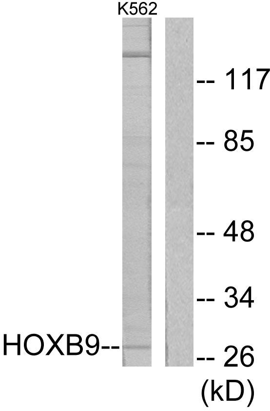 HOXB9 Antibody - Western blot analysis of lysates from K562 cells, using HOXB9 Antibody. The lane on the right is blocked with the synthesized peptide.