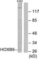 HOXB9 Antibody - Western blot analysis of lysates from K562 cells, using HOXB9 Antibody. The lane on the right is blocked with the synthesized peptide.