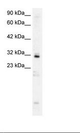 HOXB9 Antibody - HepG2 Cell Lysate.  This image was taken for the unconjugated form of this product. Other forms have not been tested.