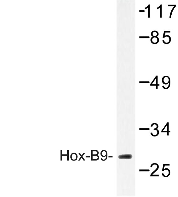 HOXB9 Antibody - Western blot of Hox-B9 (R237) pAb in extracts from K562 cells.