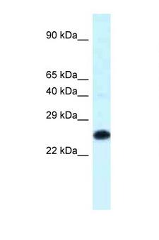 HOXB9 Antibody - HOXB9 antibody Western blot of Mouse Thymus lysate. Antibody concentration 1 ug/ml.  This image was taken for the unconjugated form of this product. Other forms have not been tested.
