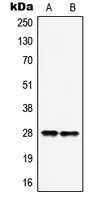 HOXB9 Antibody - Western blot analysis of HOXB9 expression in MCF7 (A); HepG2 (B) whole cell lysates.