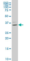 HOXB9 Antibody - HOXB9 monoclonal antibody (M01), clone 3C8 Western Blot analysis of HOXB9 expression in HepG2.