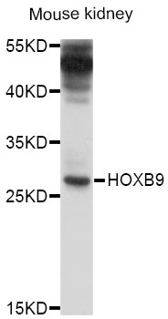 HOXB9 Antibody - Western blot analysis of extracts of mouse kidney, using HOXB9 antibody at 1:1000 dilution. The secondary antibody used was an HRP Goat Anti-Rabbit IgG (H+L) at 1:10000 dilution. Lysates were loaded 25ug per lane and 3% nonfat dry milk in TBST was used for blocking. An ECL Kit was used for detection and the exposure time was 30s.