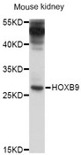 HOXB9 Antibody - Western blot analysis of extracts of mouse kidney, using HOXB9 antibody at 1:1000 dilution. The secondary antibody used was an HRP Goat Anti-Rabbit IgG (H+L) at 1:10000 dilution. Lysates were loaded 25ug per lane and 3% nonfat dry milk in TBST was used for blocking. An ECL Kit was used for detection and the exposure time was 30s.