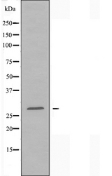 HOXB9 Antibody - Western blot analysis of extracts of K562 cells using HOXB9 antibody.