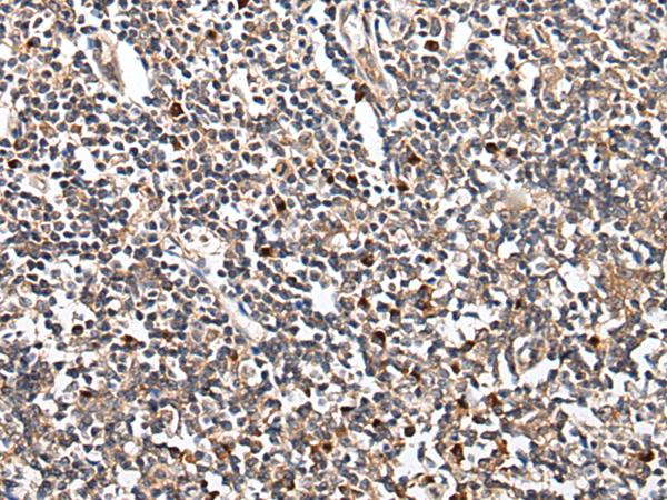 HOXB9 Antibody - Immunohistochemistry of paraffin-embedded Human tonsil tissue  using HOXB9 Polyclonal Antibody at dilution of 1:45(×200)