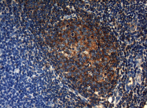 HOXC10 Antibody - Immunohistochemical staining of paraffin-embedded Human tonsil within the normal limits using anti-HOXC10 mouse monoclonal antibody. (Heat-induced epitope retrieval by 1mM EDTA in 10mM Tris buffer. (pH8.5) at 120°C for 3 min. (1:150)