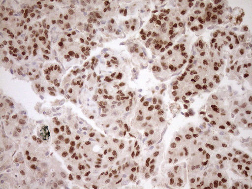 HOXC10 Antibody - Immunohistochemical staining of paraffin-embedded Human liver tissue within the normal limits using anti-HOXC10 mouse monoclonal antibody. (Heat-induced epitope retrieval by 1mM EDTA in 10mM Tris buffer. (pH8.5) at 120°C for 3 min. (1:150)