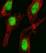 HOXC10 Antibody - Fluorescent image of HeLa cell stained with HOXC10 Antibody. HeLa cells were fixed with 4% PFA (20 min), permeabilized with Triton X-100 (0.1%, 10 min), then incubated with HOXC10 primary antibody (1:25, 1 h at 37°C). For secondary antibody, Alexa Fluor 488 conjugated donkey anti-rabbit antibody (green) was used (1:400, 50 min at 37°C). Cytoplasmic actin was counterstained with Alexa Fluor 555 (red) conjugated Phalloidin (7units/ml, 1 h at 37°C). HOXC10 immunoreactivity is localized to Nucleus significantly.