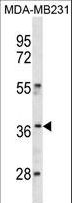 HOXC10 Antibody - HOXC10 Antibody western blot of MDA-MB231 cell line lysates (35 ug/lane). The HOXC10 antibody detected the HOXC10 protein (arrow).