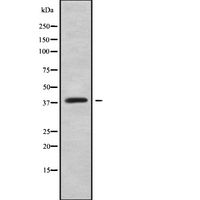 HOXC10 Antibody - Western blot analysis of HOXC10 using Jurkat whole cells lysates