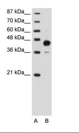 HOXC10 Antibody - A: Marker, B: Transfected 293T Cell Lysate.  This image was taken for the unconjugated form of this product. Other forms have not been tested.