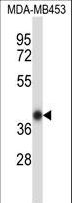 HOXC11 Antibody - Mouse Hoxc11 Antibody western blot of MDA-MB453 cell line lysates (35 ug/lane). The Hoxc11 antibody detected the Hoxc11 protein (arrow).