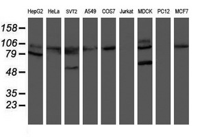 HOXC11 Antibody - Western blot of extracts (35ug) from 9 different cell lines by using anti-HOXC11 monoclonal antibody.