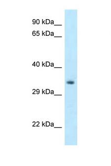 HOXC11 Antibody - HOXC11 antibody Western blot of Mouse Pancreas lysate. Antibody concentration 1 ug/ml.  This image was taken for the unconjugated form of this product. Other forms have not been tested.
