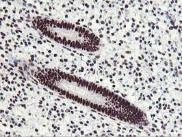 HOXC11 Antibody - IHC of paraffin-embedded Human endometrium tissue using anti-HOXC11 mouse monoclonal antibody.