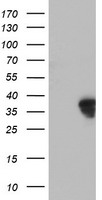 HOXC11 Antibody - HEK293T cells were transfected with the pCMV6-ENTRY control (Left lane) or pCMV6-ENTRY HOXC11 (Right lane) cDNA for 48 hrs and lysed. Equivalent amounts of cell lysates (5 ug per lane) were separated by SDS-PAGE and immunoblotted with anti-HOXC11.