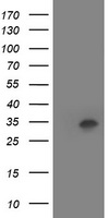 HOXC11 Antibody - HEK293T cells were transfected with the pCMV6-ENTRY control (Left lane) or pCMV6-ENTRY HOXC11 (Right lane) cDNA for 48 hrs and lysed. Equivalent amounts of cell lysates (5 ug per lane) were separated by SDS-PAGE and immunoblotted with anti-HOXC11.